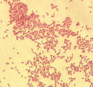 Brucellose - Une maladie dangereuse