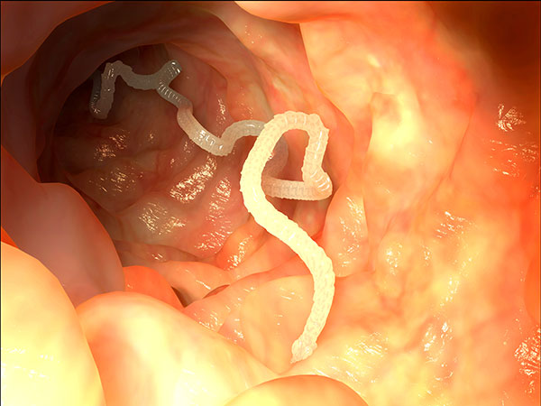 Tapeworm_intestine.jpg